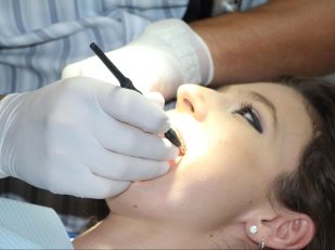 How Dental Implants Are Reimagining Modern Smiles
