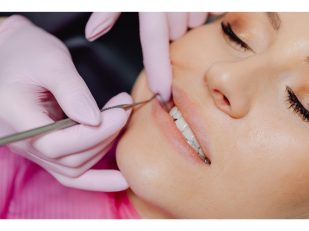 Why Cosmetic Dentistry Is About More Than a Brighter Smile