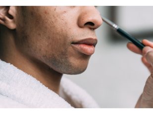 Azelaic Acid for Hyperpigmentation and Dark Spots: What to Know