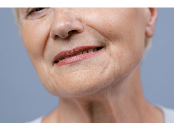 Can an RF Facial Machine Help Reduce the Appearance of Fine Lines?