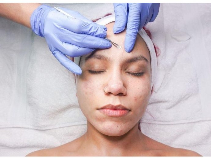 When a Breakout Needs More Than a Spot Patch: What You Should Know About Fast Acne Fixes