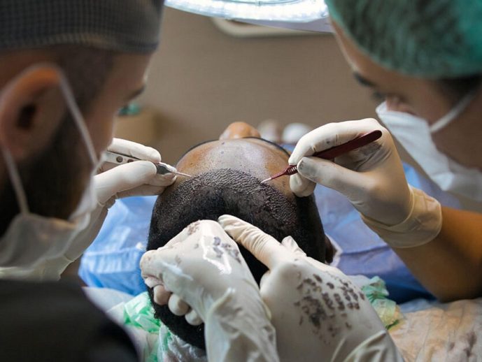 International Hair Transplant Safety, Costs, and Surgeons