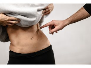 Renuvion Body Contouring Consultation: Explore Suitable Treatment Options