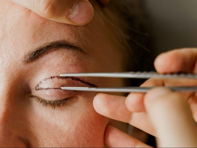 Elevate Your Look with Blepharoplasty and Facial Plastic Surgery