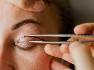 Elevate Your Look with Blepharoplasty and Facial Plastic Surgery