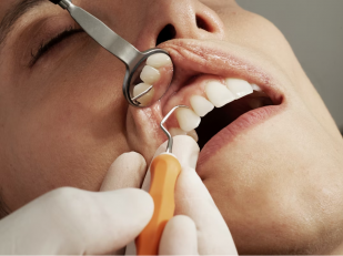 The New Luxury Standard: Achieving a Perfect Smile Through Cosmetic Dentistry